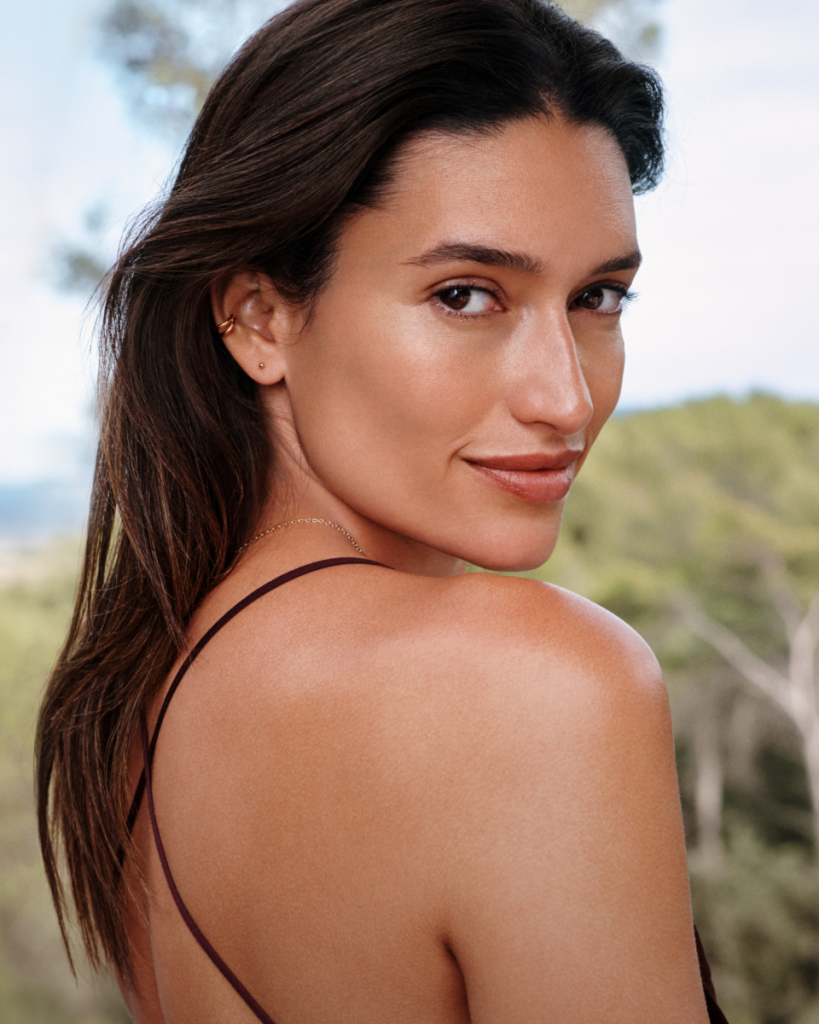 Sculptra in Chicago patient at Bliss Med Spa.