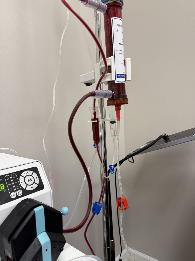 EBOO therapy in active treatment session at Bliss MD — single-use sterile filter, blood filtration column, peristaltic pump, and closed sterile circuit performing authentic Extracorporeal Blood Oxygenation and Ozonation for an Oak Brook patient under Dr. Anand Thakkar MD's supervision